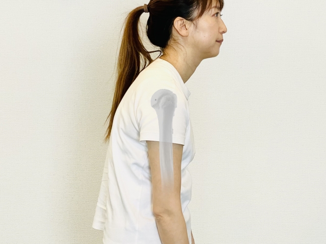 猫背・巻き肩の女性